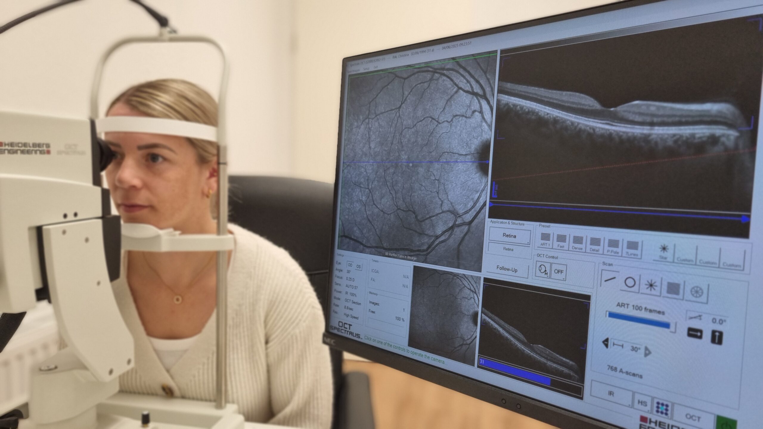 Optische Kohärenztomographie (OCT)